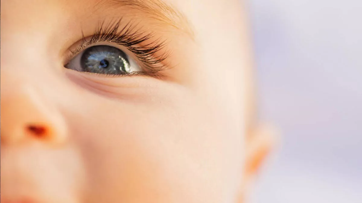 infants cataracts